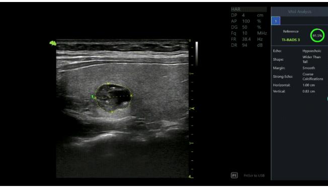 M&aacute;y si&ecirc;u &acirc;m 5D Vinno R500